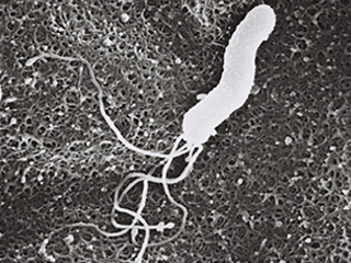ピロリ菌 1